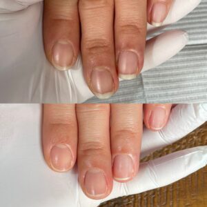 メンズネイルケアBefore After